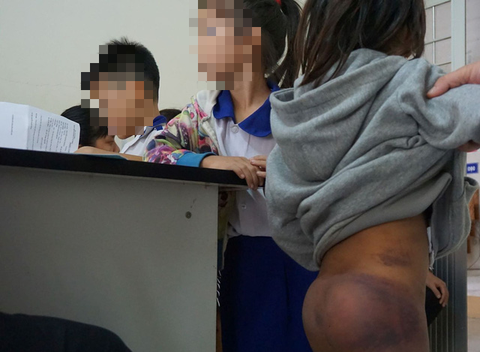 Công an xác minh 4 học sinh nghi bị ông nội đánh bầm mình - Ảnh 2. Công an xác minh 4 học sinh nghi bị ông nội đánh bầm mình - Ảnh 2.