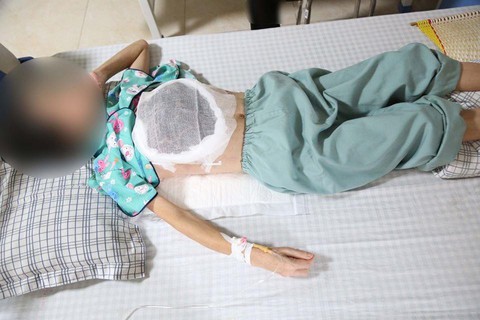 Dùng thuốc nam chữa ung thư, nữ bệnh nhân bị hoại tử một bên ngực - Ảnh 1. Dùng thuốc nam chữa ung thư, nữ bệnh nhân bị hoại tử một bên ngực - Ảnh 1.