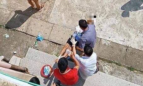 Bé trai 10 tuổi bất ngờ bị bác ruột chém lìa tay - Ảnh 1. Bé trai 10 tuổi bất ngờ bị bác ruột chém lìa tay - Ảnh 1.