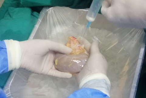 Bệnh viện Đa khoa Thanh Hóa ghép thận thành công từ người chết não - Ảnh 3. Bệnh viện Đa khoa Thanh Hóa ghép thận thành công từ người chết não - Ảnh 3.