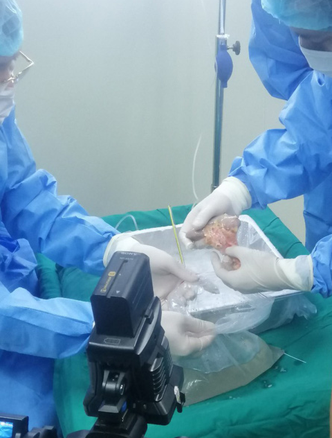 Bệnh viện Đa khoa Thanh Hóa ghép thận thành công từ người chết não - Ảnh 1. Bệnh viện Đa khoa Thanh Hóa ghép thận thành công từ người chết não - Ảnh 1.