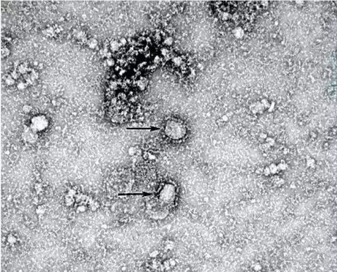 Mất bao lâu mới có được văcxin ngừa virus corona mới? - Ảnh 1. Mất bao lâu mới có được văcxin ngừa virus corona mới? - Ảnh 1.