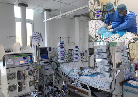 Vừa ECMO vừa lọc máu liên tục, cứu bé sơ sinh nguy kịch sau mổ tim bẩm sinh - Ảnh 1. Vừa ECMO vừa lọc máu liên tục, cứu bé sơ sinh nguy kịch sau mổ tim bẩm sinh - Ảnh 1.
