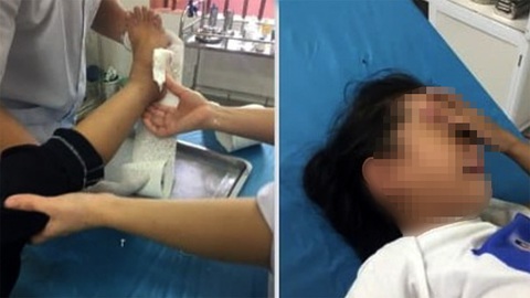 Học sinh tiểu học nhập viện vì cổng trường đổ sập đè trúng - Ảnh 1. Học sinh tiểu học nhập viện vì cổng trường đổ sập đè trúng - Ảnh 1.