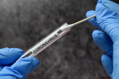 Người tham gia thử nghiệm vắcxin COVID-19 của Moderna và Pfizer gặp tác dụng phụ nặng - Ảnh 1. Người tham gia thử nghiệm vắcxin COVID-19 của Moderna và Pfizer gặp tác dụng phụ nặng - Ảnh 1.