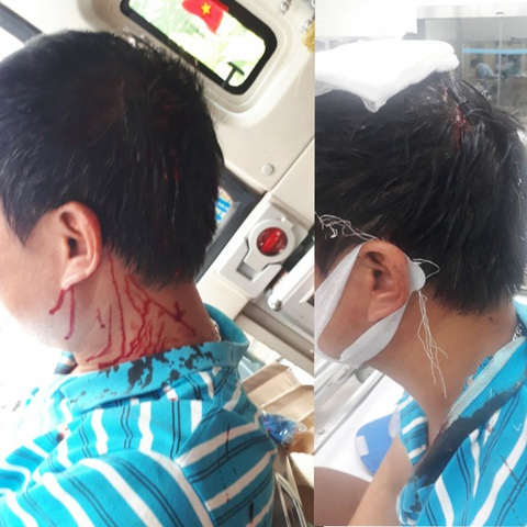 Công ty vận tải khốn khổ vì bị hiểu nhầm có phụ xe đánh người - Ảnh 1. Công ty vận tải khốn khổ vì bị hiểu nhầm có phụ xe đánh người - Ảnh 1.