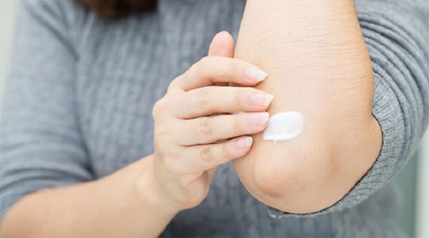 Viêm da cơ địa có nguy hiểm không? - Ảnh 2. Viêm da cơ địa có nguy hiểm không? - Ảnh 2.