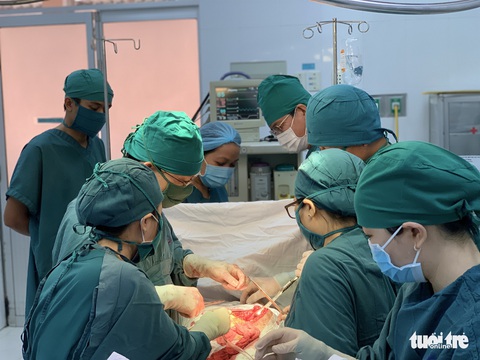 Cắt khối u hiếm gặp nặng hơn 3kg trong ổ bụng một phụ nữ - Ảnh 1. Cắt khối u hiếm gặp nặng hơn 3kg trong ổ bụng một phụ nữ - Ảnh 1.