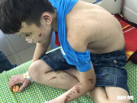 Vụ bé trai bị bạo hành: Hàng xóm có nghi ngờ nhưng không ai để ý - Ảnh 3. Vụ bé trai bị bạo hành: Hàng xóm có nghi ngờ nhưng không ai để ý - Ảnh 3.