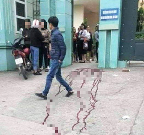 Va quẹt xe khi chen vào trường, một phụ huynh bị đâm trọng thương - Ảnh 1. Va quẹt xe khi chen vào trường, một phụ huynh bị đâm trọng thương - Ảnh 1.