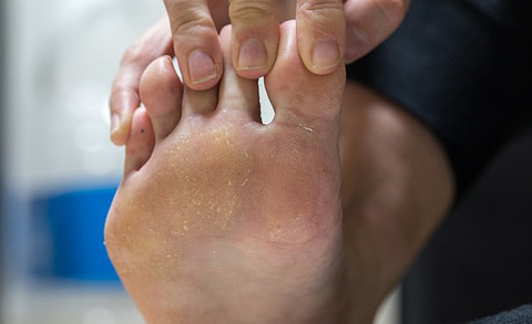 Phủ nano trên vớ để trị hôi chân - Ảnh 1. Phủ nano trên vớ để trị hôi chân - Ảnh 1.