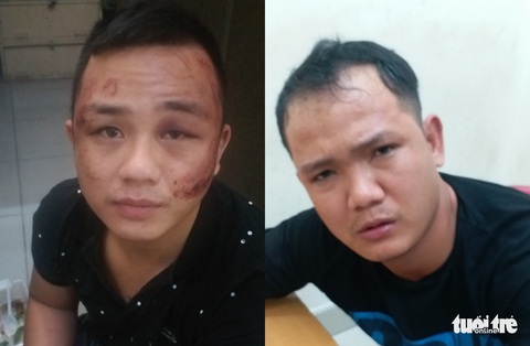 Bắt 2 tên trộm xe máy nổ súng bắn tổ trinh sát khi bị truy đuổi - Ảnh 1. Bắt 2 tên trộm xe máy nổ súng bắn tổ trinh sát khi bị truy đuổi - Ảnh 1.