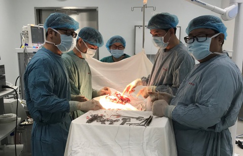 Tưởng béo bụng, không ngờ bị khối u nặng 3,5kg dính gan, dạ dày - Ảnh 1. Tưởng béo bụng, không ngờ bị khối u nặng 3,5kg dính gan, dạ dày - Ảnh 1.