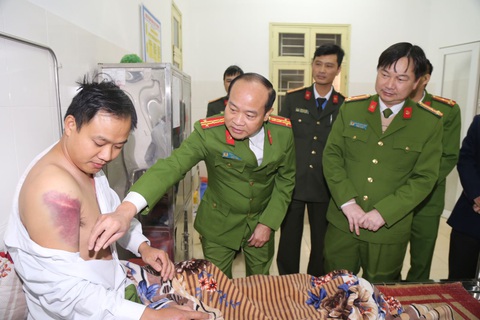Hai thanh niên trộm chó tông xe vào đội tuần tra, chém công an xã - Ảnh 1. Hai thanh niên trộm chó tông xe vào đội tuần tra, chém công an xã - Ảnh 1.