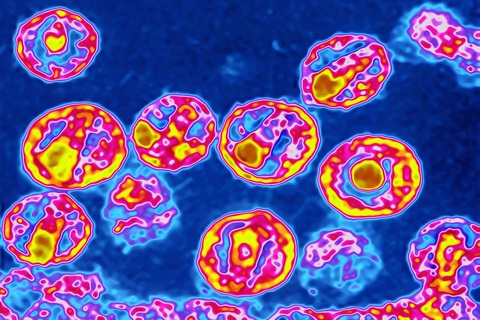 Sau vắc xin COVID-19, thế giới sẽ có vắc xin AIDS? - Ảnh 1. Sau vắc xin COVID-19, thế giới sẽ có vắc xin AIDS? - Ảnh 1.