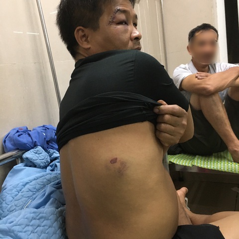 Lỡ quẹt trúng ghiđông xe đạp hàng xóm mà bị đánh bằng dao, cuốc đến mờ mắt? - Ảnh 1. Lỡ quẹt trúng ghiđông xe đạp hàng xóm mà bị đánh bằng dao, cuốc đến mờ mắt? - Ảnh 1.