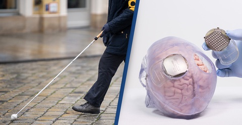 Nghiên cứu mới: Cấy điện cực khôi phục thị lực cho người mù - Ảnh 2. Nghiên cứu mới: Cấy điện cực khôi phục thị lực cho người mù - Ảnh 2.