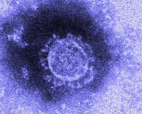 Nhật Bản cô lập thành công virus corona - Ảnh 1. Nhật Bản cô lập thành công virus corona - Ảnh 1.