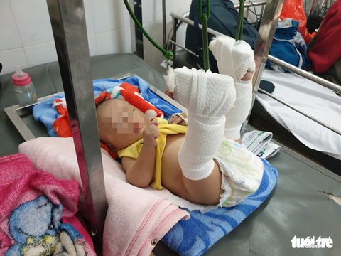 Bé trai 4 tháng tuổi bị cha bạo hành gãy chân, chấn thương đầu... ở mức thương tích 37% - Ảnh 3. Bé trai 4 tháng tuổi bị cha bạo hành gãy chân, chấn thương đầu... ở mức thương tích 37% - Ảnh 3.