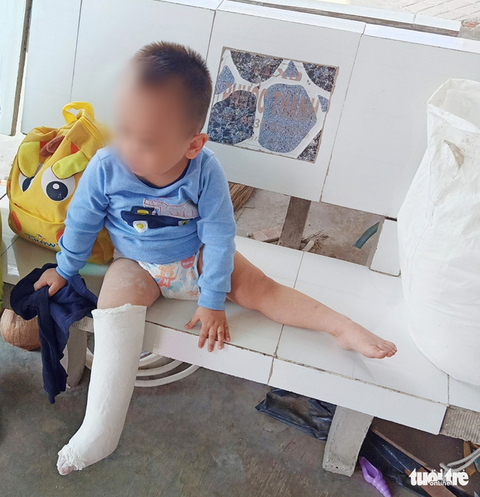 Nghi vấn bé trai 3 tuổi gãy chân bất thường tại điểm giữ trẻ - Ảnh 3. Nghi vấn bé trai 3 tuổi gãy chân bất thường tại điểm giữ trẻ - Ảnh 3.