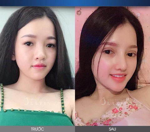 Bác Sĩ Trịnh Quang Đại – Người tái sinh nhan sắc cho phái đẹp - Ảnh 4. Bác Sĩ Trịnh Quang Đại – Người tái sinh nhan sắc cho phái đẹp - Ảnh 4.