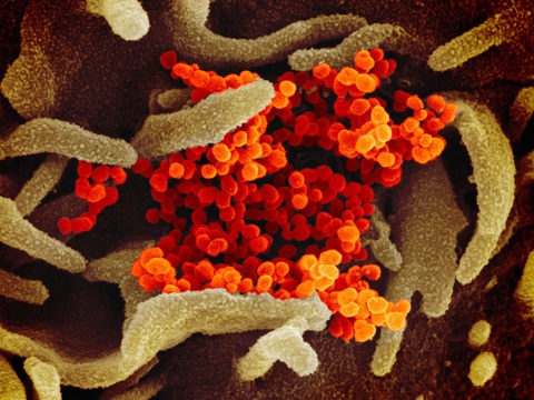 Virus corona chủng mới trông ra sao dưới kính hiển vi? - Ảnh 3. Virus corona chủng mới trông ra sao dưới kính hiển vi? - Ảnh 3.
