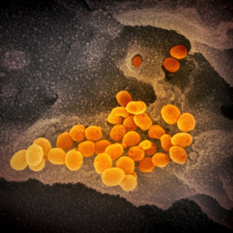 Virus corona chủng mới trông ra sao dưới kính hiển vi? - Ảnh 2. Virus corona chủng mới trông ra sao dưới kính hiển vi? - Ảnh 2.