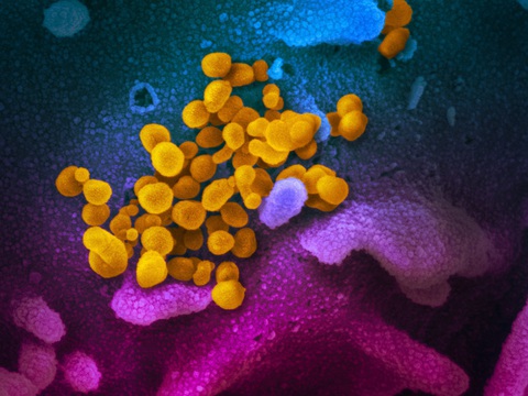 Virus corona chủng mới trông ra sao dưới kính hiển vi? - Ảnh 1. Virus corona chủng mới trông ra sao dưới kính hiển vi? - Ảnh 1.