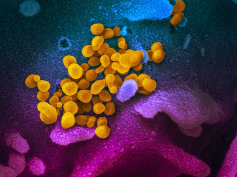 Virus corona tàn phá cơ thể người ra sao? - Ảnh 2. Virus corona tàn phá cơ thể người ra sao? - Ảnh 2.