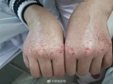 Bác sĩ ở Vũ Hán phải mặc tã làm việc, bị đánh và thiếu tiếp tế - Ảnh 2. Bác sĩ ở Vũ Hán phải mặc tã làm việc, bị đánh và thiếu tiếp tế - Ảnh 2.