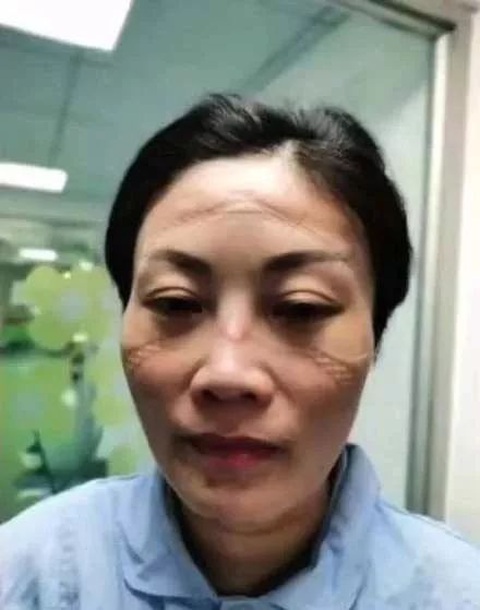 Bác sĩ ở Vũ Hán phải mặc tã làm việc, bị đánh và thiếu tiếp tế - Ảnh 1. Bác sĩ ở Vũ Hán phải mặc tã làm việc, bị đánh và thiếu tiếp tế - Ảnh 1.