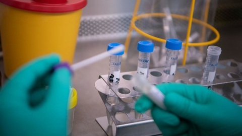 Người Hàn Quốc tử vong tại Bắc Ninh âm tính với virus SARS-CoV-2 - Ảnh 1. Người Hàn Quốc tử vong tại Bắc Ninh âm tính với virus SARS-CoV-2 - Ảnh 1.