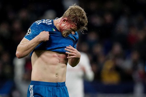 De Ligt được khen vì dù va chạm chảy máu đầu vẫn thi đấu kiên cường - Ảnh 2. De Ligt được khen vì dù va chạm chảy máu đầu vẫn thi đấu kiên cường - Ảnh 2.