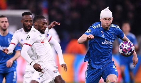 De Ligt được khen vì dù va chạm chảy máu đầu vẫn thi đấu kiên cường - Ảnh 1. De Ligt được khen vì dù va chạm chảy máu đầu vẫn thi đấu kiên cường - Ảnh 1.