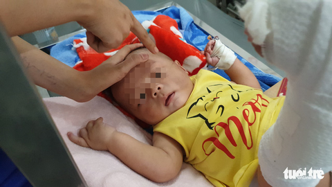 Bé trai 4 tháng tuổi gãy xương, xuất huyết não, bầm nhiều chỗ, người nhà nói té võng - Ảnh 4. Bé trai 4 tháng tuổi gãy xương, xuất huyết não, bầm nhiều chỗ, người nhà nói té võng - Ảnh 4.