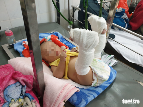 Bắt người cha bạo hành con 4 tháng tuổi xuất huyết não, gãy chân - Ảnh 2. Bắt người cha bạo hành con 4 tháng tuổi xuất huyết não, gãy chân - Ảnh 2.