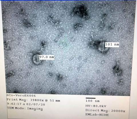 Việt Nam nuôi cấy và phân lập thành công virus corona mới - Ảnh 1. Việt Nam nuôi cấy và phân lập thành công virus corona mới - Ảnh 1.
