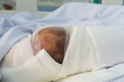 Nhiều bệnh nhân suy thận, chết khi uống ‘thần dược gia truyền’ trị tiểu đường - Ảnh 3. Nhiều bệnh nhân suy thận, chết khi uống ‘thần dược gia truyền’ trị tiểu đường - Ảnh 3.
