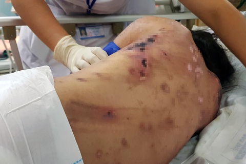 Khởi tố chủ quán cà phê tra tấn, chích điện ép nữ tiếp viên kích dục cho khách - Ảnh 2. Khởi tố chủ quán cà phê tra tấn, chích điện ép nữ tiếp viên kích dục cho khách - Ảnh 2.