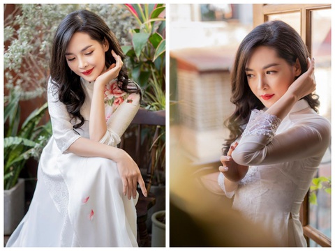 Cô gái bị miệt thị ngoại hình trở nên xinh đẹp hơn nhờ phẫu thuật thẩm mỹ - Ảnh 3. Cô gái bị miệt thị ngoại hình trở nên xinh đẹp hơn nhờ phẫu thuật thẩm mỹ - Ảnh 3.