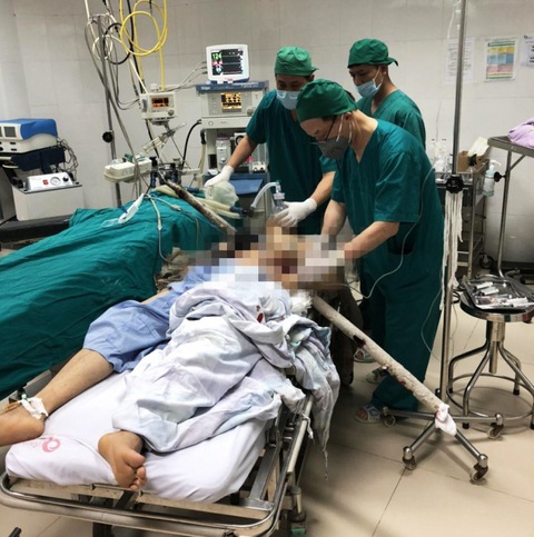 Vào viện với cọc sắt còn xuyên từ bụng lên ngực sau khi rơi từ giàn giáo 15m - Ảnh 1. Vào viện với cọc sắt còn xuyên từ bụng lên ngực sau khi rơi từ giàn giáo 15m - Ảnh 1.