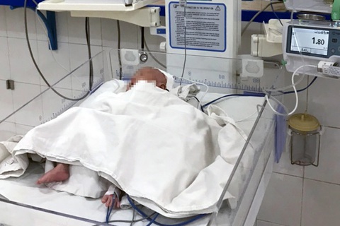 Cứu sống bé sơ sinh nhẹ cân thủng dạ dày kèm dị tật tắc tá tràng - Ảnh 1. Cứu sống bé sơ sinh nhẹ cân thủng dạ dày kèm dị tật tắc tá tràng - Ảnh 1.
