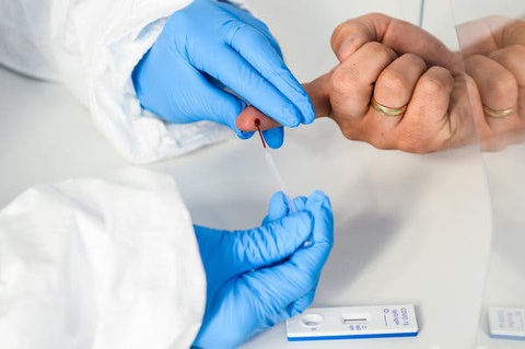 Các nước xét nghiệm kháng thể trong máu để truy bệnh nhân COVID-19 không triệu chứng - Ảnh 1. Các nước xét nghiệm kháng thể trong máu để truy bệnh nhân COVID-19 không triệu chứng - Ảnh 1.