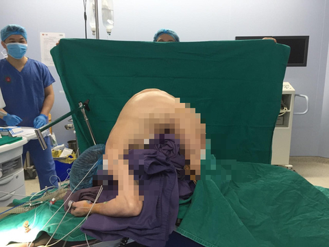 Phẫu thuật nắn chỉnh cột sống cho bệnh nhân 10 năm không được nằm bình thường - Ảnh 1. Phẫu thuật nắn chỉnh cột sống cho bệnh nhân 10 năm không được nằm bình thường - Ảnh 1.