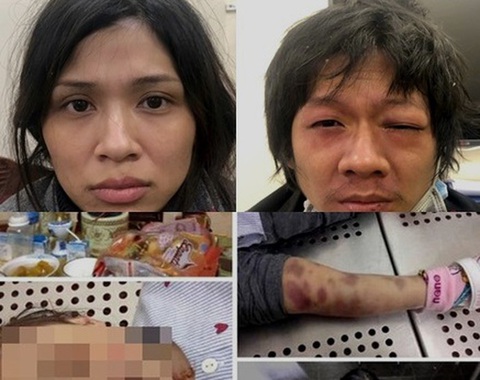 Mẹ và cha dượng đánh con gái 3 tuổi đến chết - Ảnh 1. Mẹ và cha dượng đánh con gái 3 tuổi đến chết - Ảnh 1.