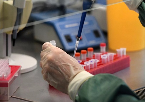 Xét nghiệm thấy virus corona cả khi người nhiễm chưa phát bệnh - Ảnh 1. Xét nghiệm thấy virus corona cả khi người nhiễm chưa phát bệnh - Ảnh 1.