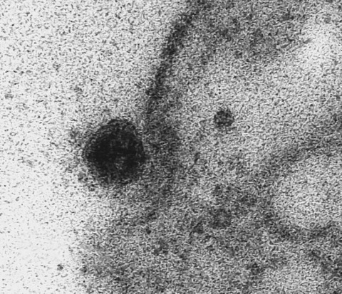 Lần đầu ghi được khoảnh khắc virus corona tấn công tế bào - Ảnh 2. Lần đầu ghi được khoảnh khắc virus corona tấn công tế bào - Ảnh 2.