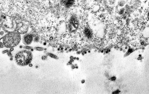Lần đầu ghi được khoảnh khắc virus corona tấn công tế bào - Ảnh 1. Lần đầu ghi được khoảnh khắc virus corona tấn công tế bào - Ảnh 1.