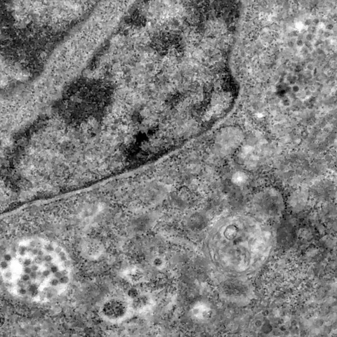 Lần đầu ghi được khoảnh khắc virus corona tấn công tế bào - Ảnh 3. Lần đầu ghi được khoảnh khắc virus corona tấn công tế bào - Ảnh 3.