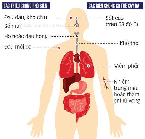 10 người dân Việt Nam hiến phổi cứu phi công Anh, ngành y tìm nguồn từ người chết não - Ảnh 3. 10 người dân Việt Nam hiến phổi cứu phi công Anh, ngành y tìm nguồn từ người chết não - Ảnh 3.